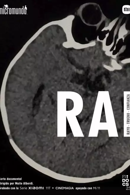 RAI